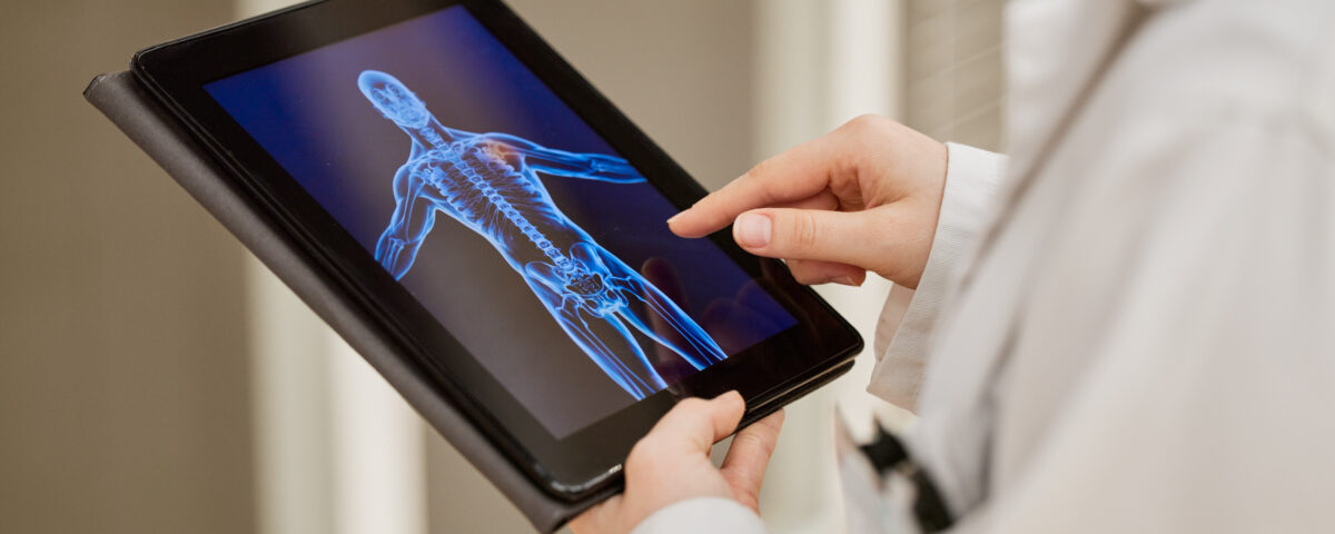 doctor hands and tablet x ray mri results and healthcare research anatomy solution and injury re